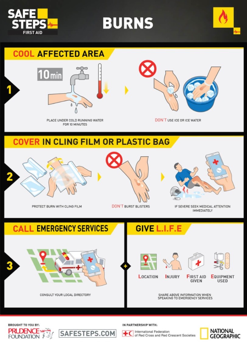 SAFE STEPS First Aid hand-out card: Burns